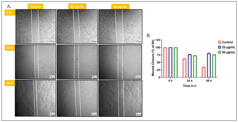 Figure 11