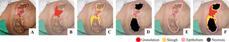 Fig 2