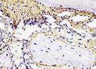 Figure 23