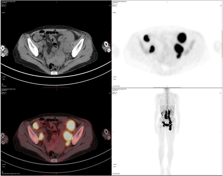 Figure 1