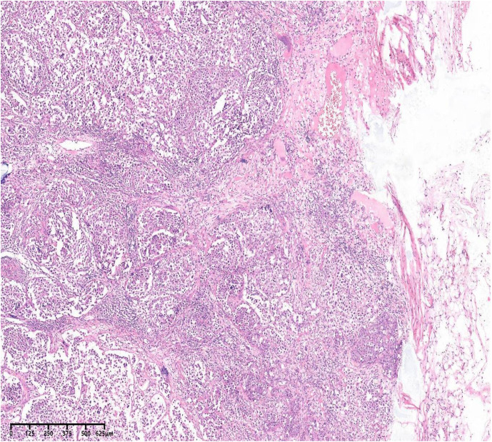 Figure 2