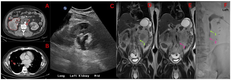Figure 1