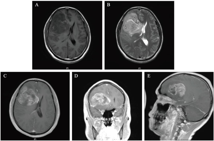 Figure 2