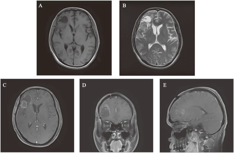 Figure 5