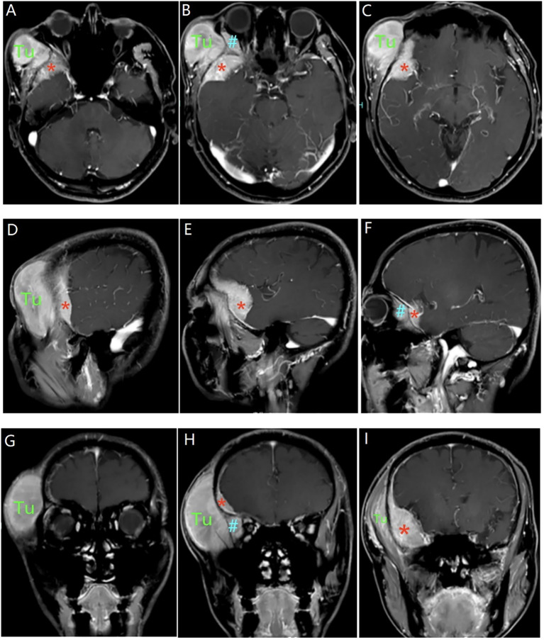 Figure 2