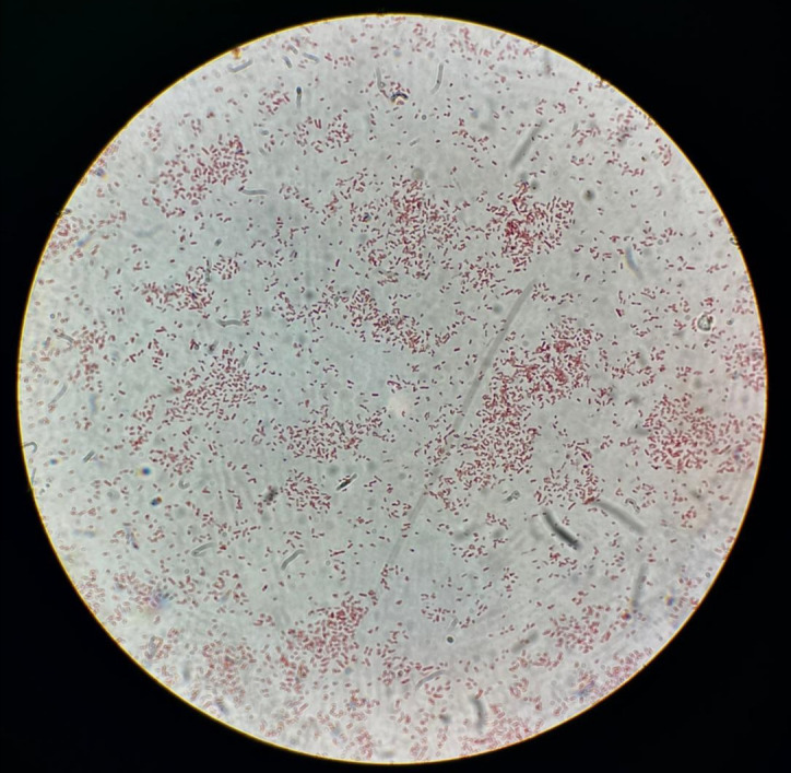 Figure 2