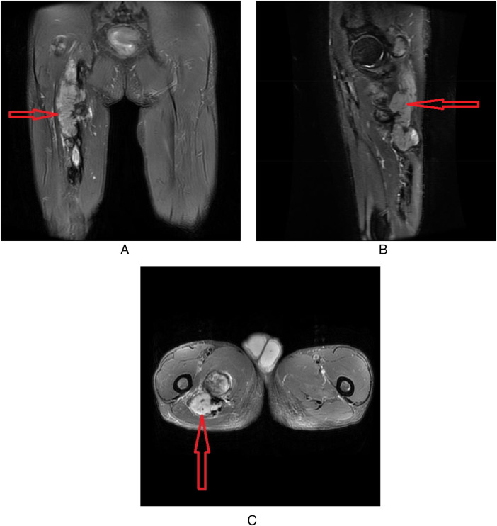 Figure 2