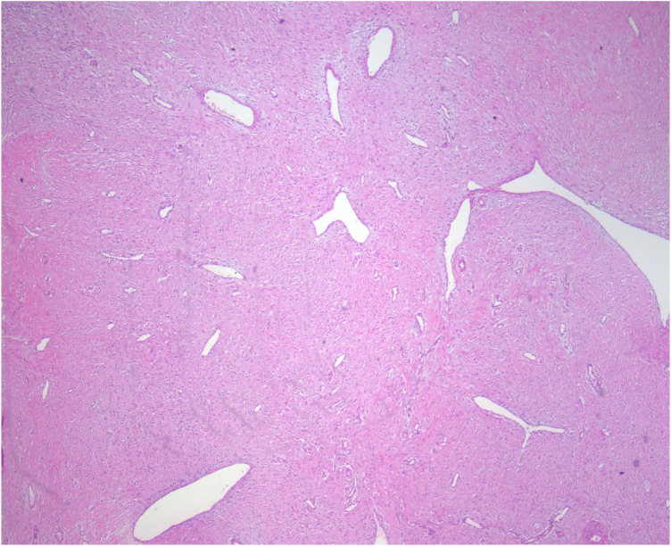 Figure 4