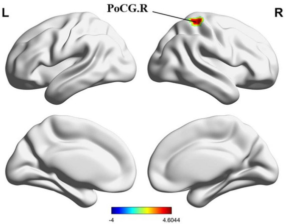 FIGURE 13