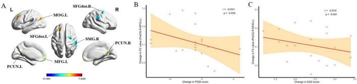 FIGURE 15