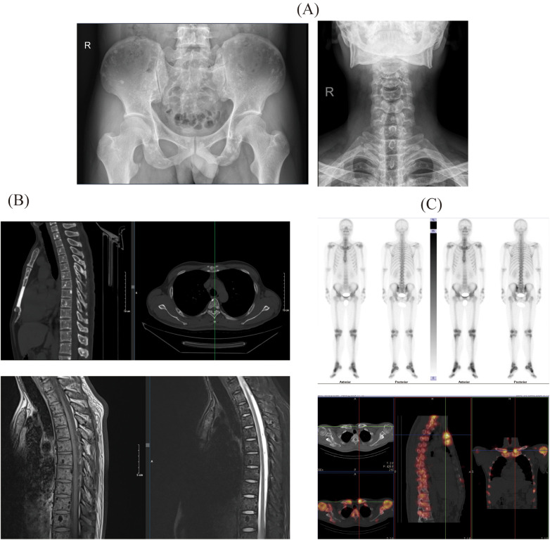 Figure 1