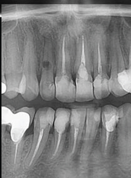Figure 12