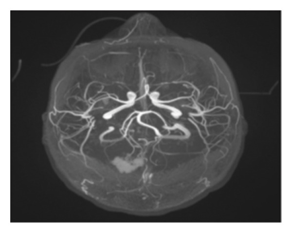 Figure 5