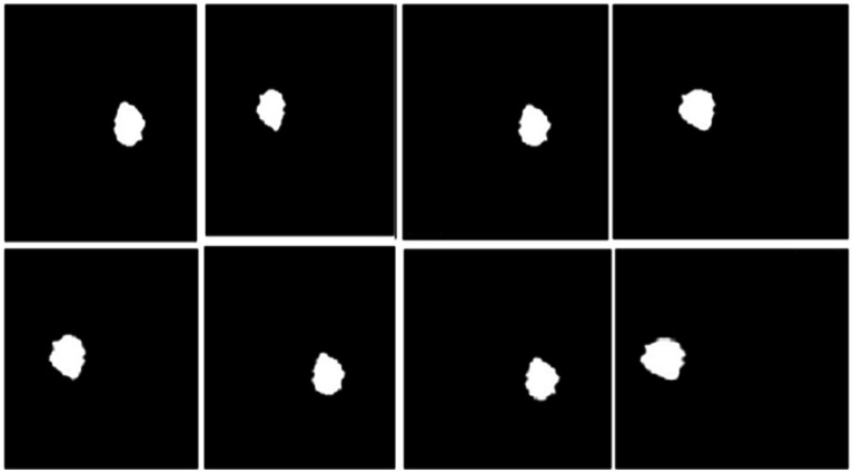 Figure 11