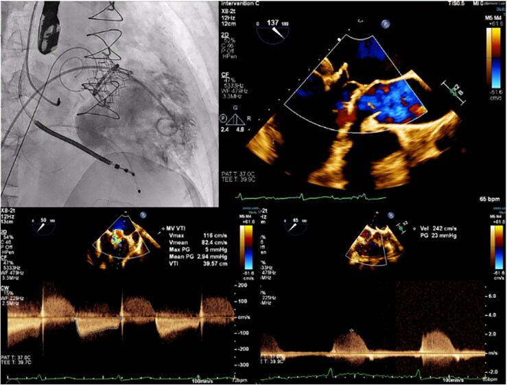 Figure 6