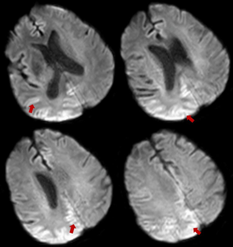 Figure 6
