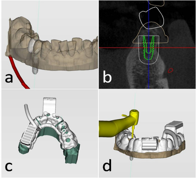 Figure 2