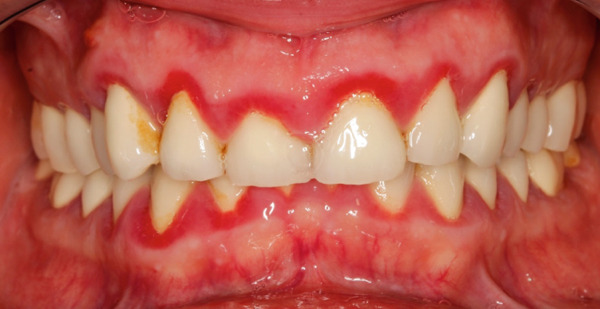 Figure 11