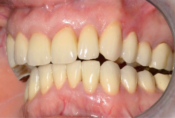 Figure 15