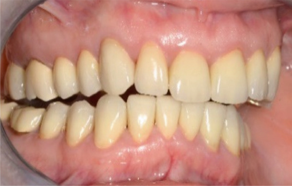 Figure 16