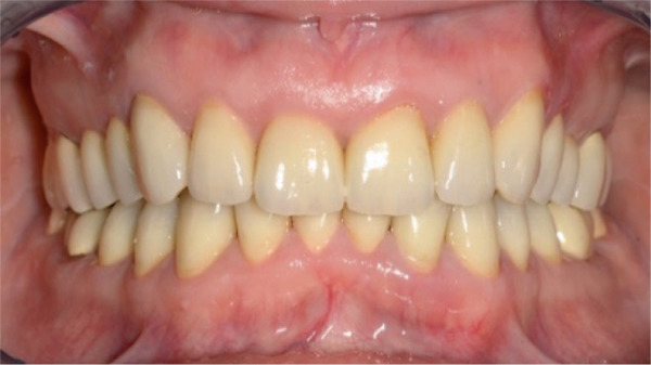 Figure 17