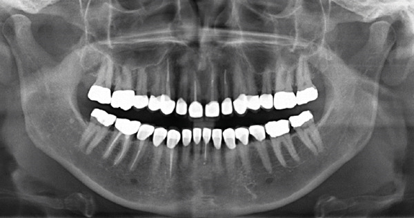 Figure 18