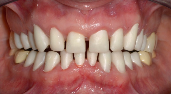 Figure 19