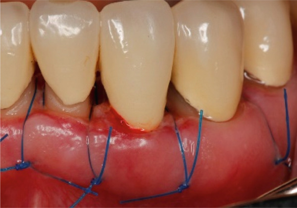 Figure 20