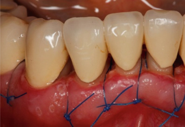Figure 21