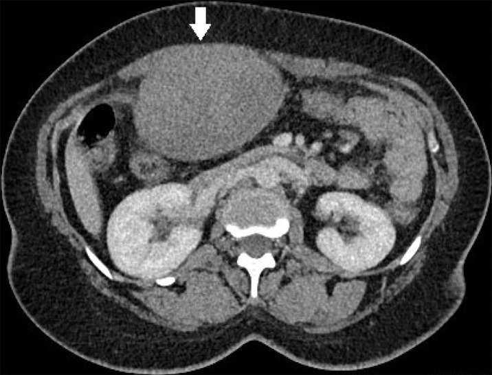 Figure 1A