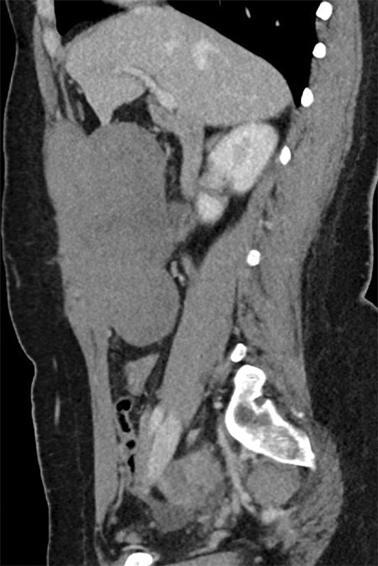 Figure 1B