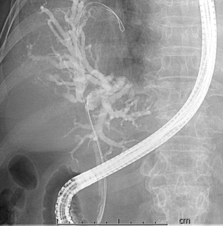 Fig. 4