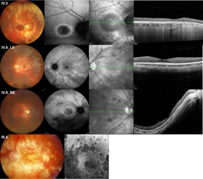 Fig. 4