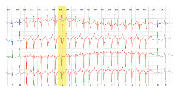 FIGURE 3
