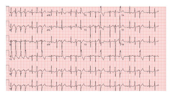 FIGURE 1