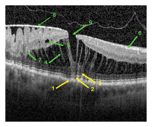 FIGURE 4