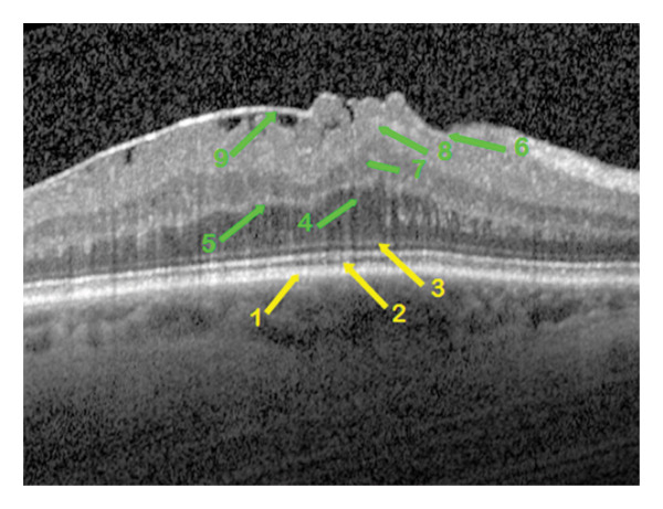 FIGURE 3