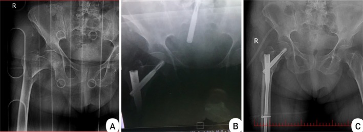 FIGURE 1
