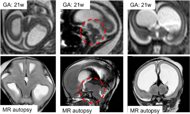 Figure 13