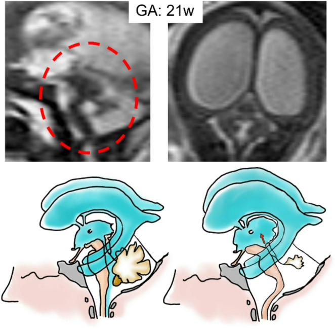 Figure 14