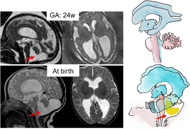 Figure 15