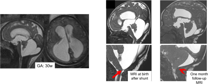 Figure 17