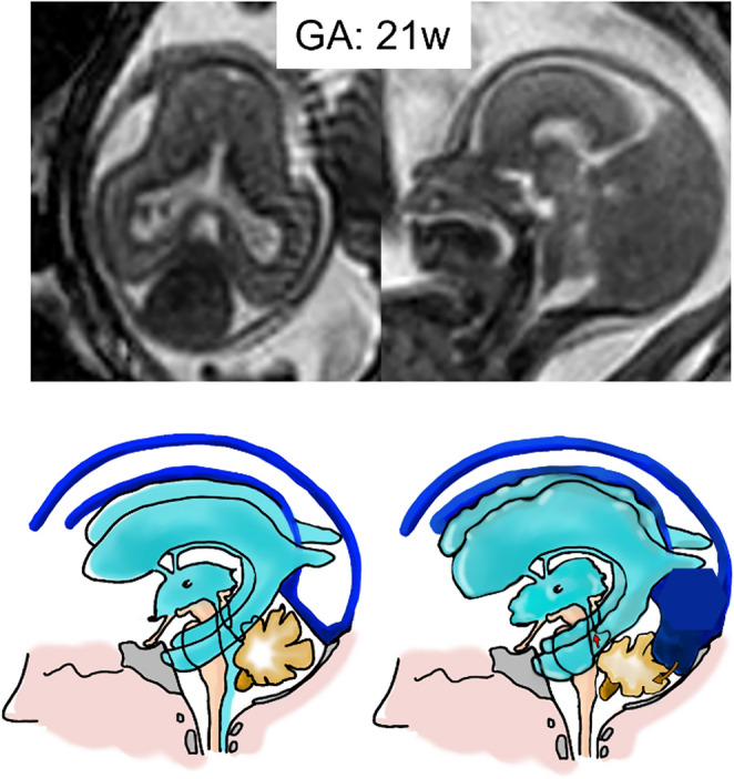 Figure 18