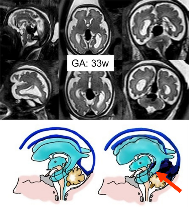 Figure 19