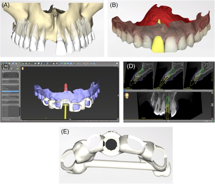Figure 6