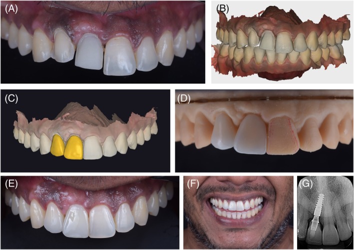 Figure 7