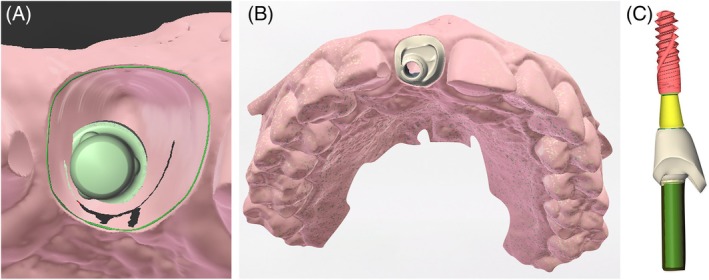 Figure 10