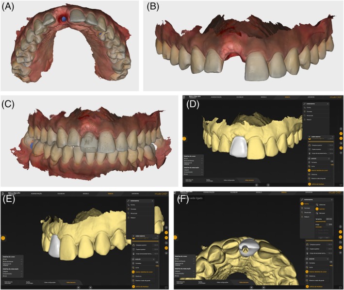 Figure 11