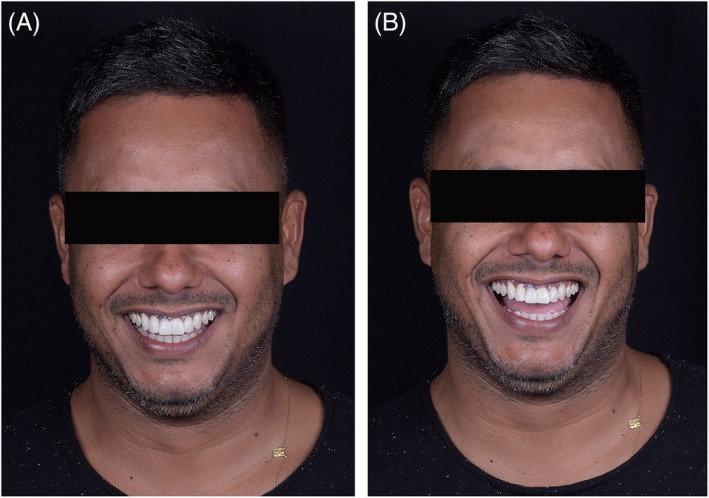 Figure 12