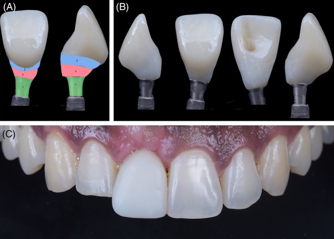 Figure 13